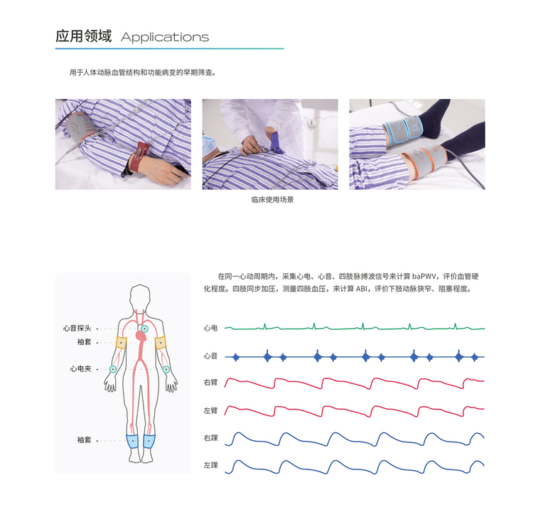 動脈硬化檢測儀應用領域