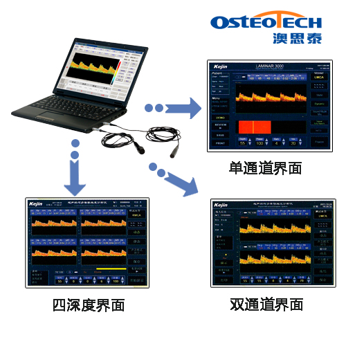 筆記本多普勒檢測圖_CT_tcd.jpg