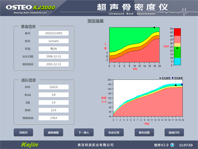 兒童骨密度檢測(cè)結(jié)果.jpg